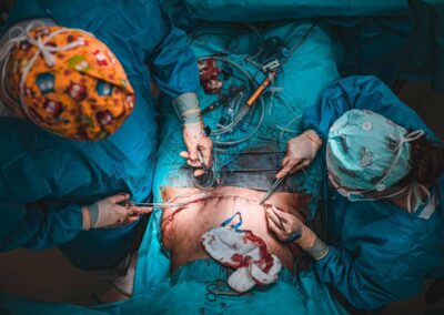 MUDr. Michal Dychus - plastická operace břicha, abdominoplastika