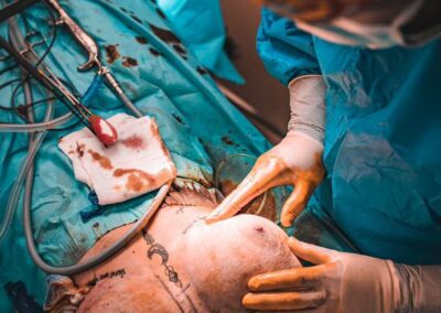 MUDr. Michal Dychus - plastická operace prsou, augmentace