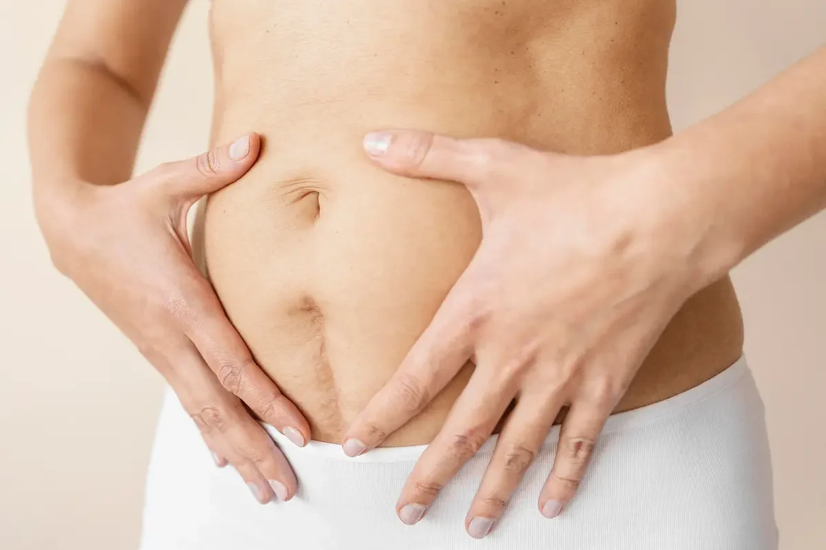 Péče o jizvy po plastické operaci – jak o ně pečovat a podpořit jejich hojení